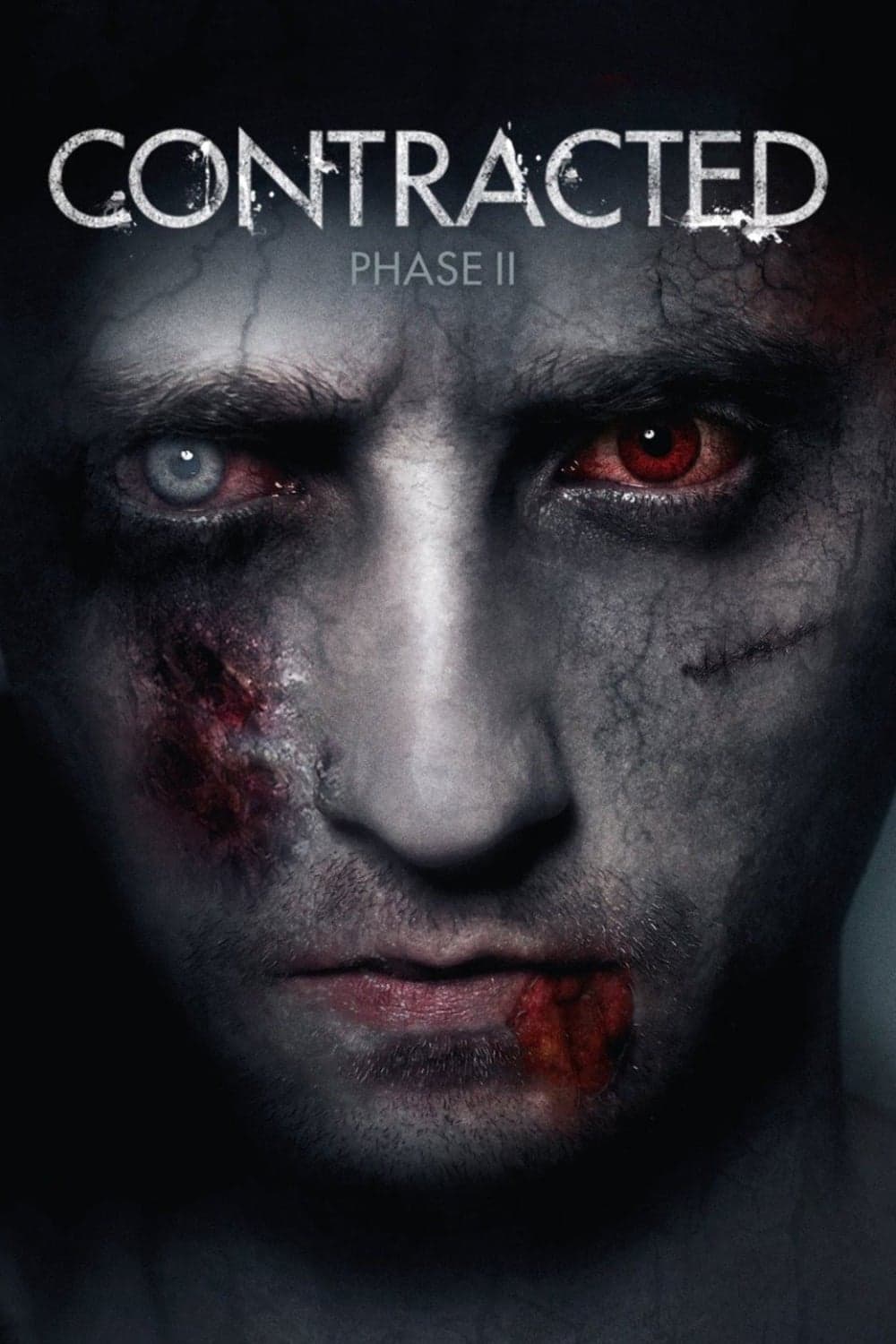 Poster Contracted: Phase II
