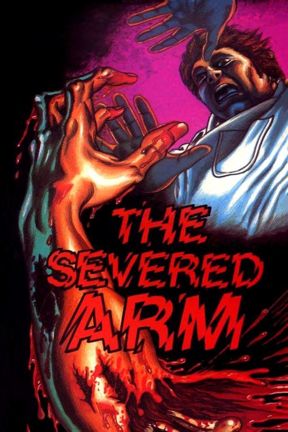 Poster The Severed Arm