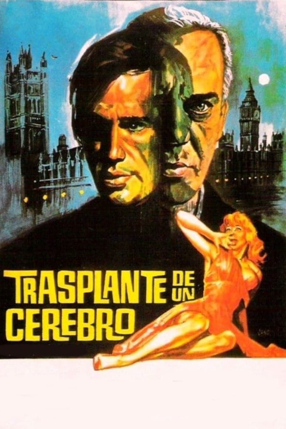 Poster Transplant of a Brain