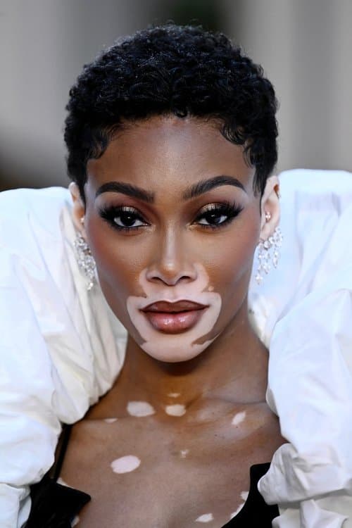 Winnie Harlow image